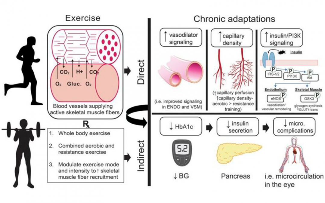 ¿Por qué es beneficioso el ejercicio en la Diabetes?